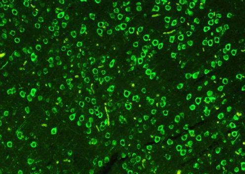 熒光素FITC-Human fibrinogen 綠色熒光素標記人血纖維蛋白原的應用